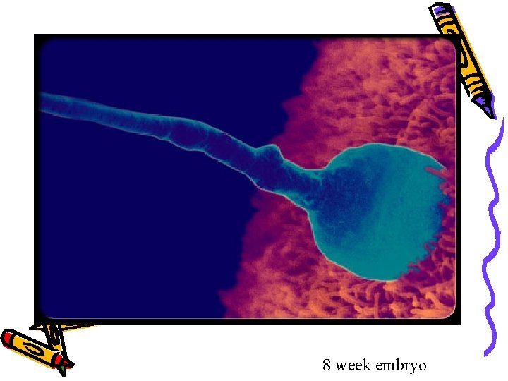 8 week embryo 