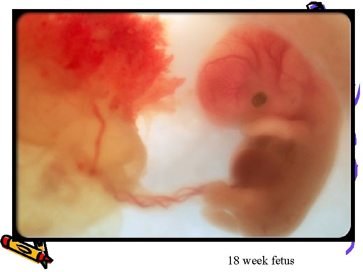 18 week fetus 