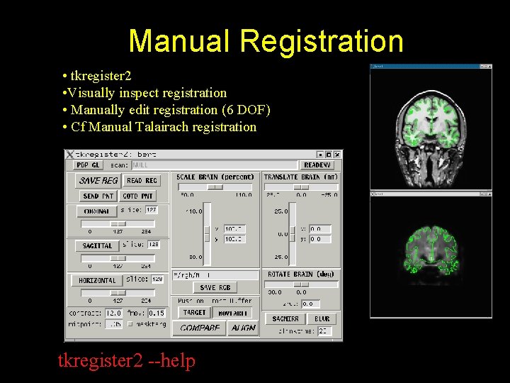 Manual Registration • tkregister 2 • Visually inspect registration • Manually edit registration (6