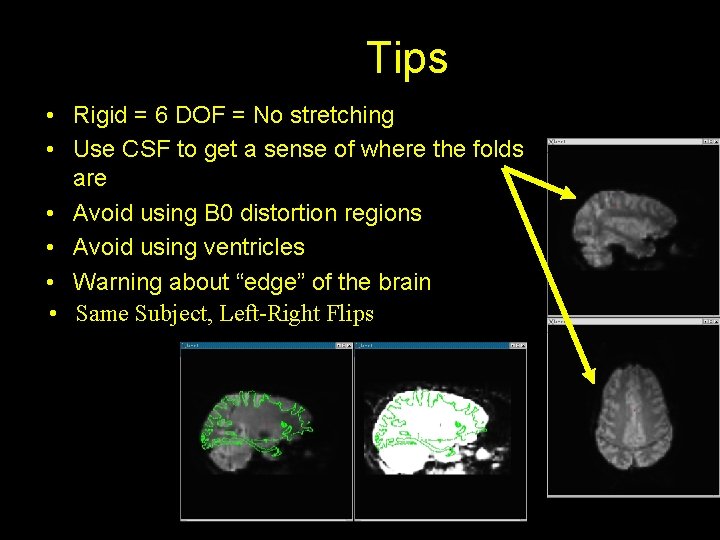 Tips • Rigid = 6 DOF = No stretching • Use CSF to get