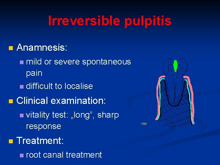 Irreversible pulpitis n n Anamnesis: n mild or severe spontaneous pain n difficult to