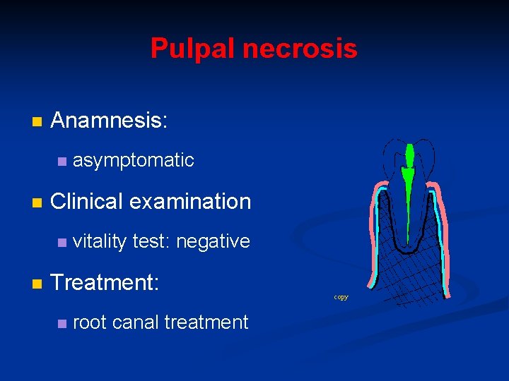 Pulpal necrosis n Anamnesis: n n Clinical examination n n asymptomatic vitality test: negative