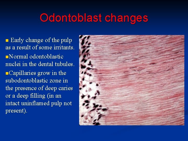 Odontoblast changes Early change of the pulp as a result of some irritants. n.