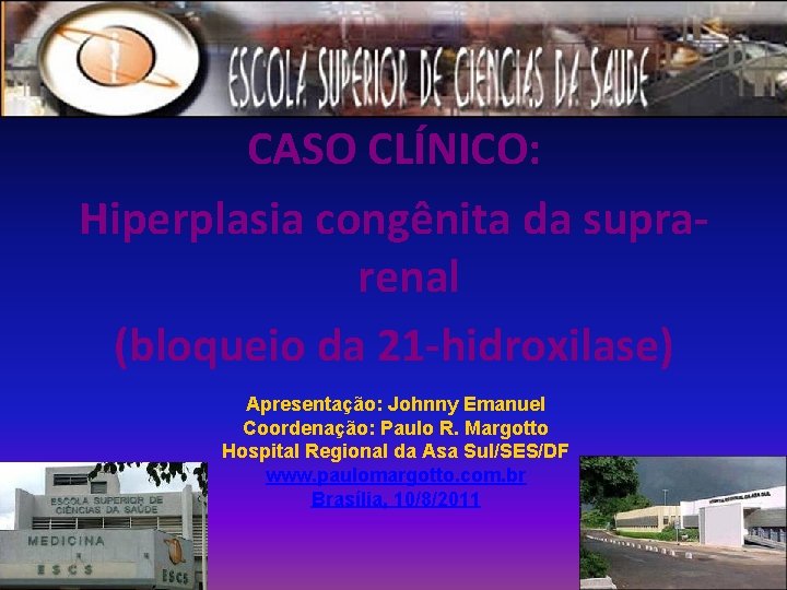 CASO CLÍNICO: Hiperplasia congênita da suprarenal (bloqueio da 21 -hidroxilase) Apresentação: Johnny Emanuel Coordenação: