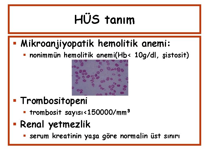 HÜS tanım Mikroanjiyopatik hemolitik anemi: nonimmün hemolitik anemi(Hb< 10 g/dl, şistosit) Trombositopeni trombosit sayısı<150000/mm