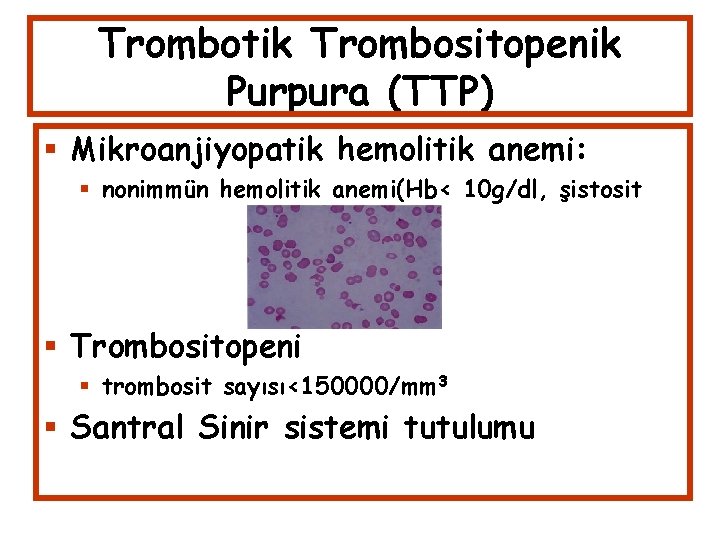Trombotik Trombositopenik Purpura (TTP) Mikroanjiyopatik hemolitik anemi: nonimmün hemolitik anemi(Hb< 10 g/dl, şistosit Trombositopeni