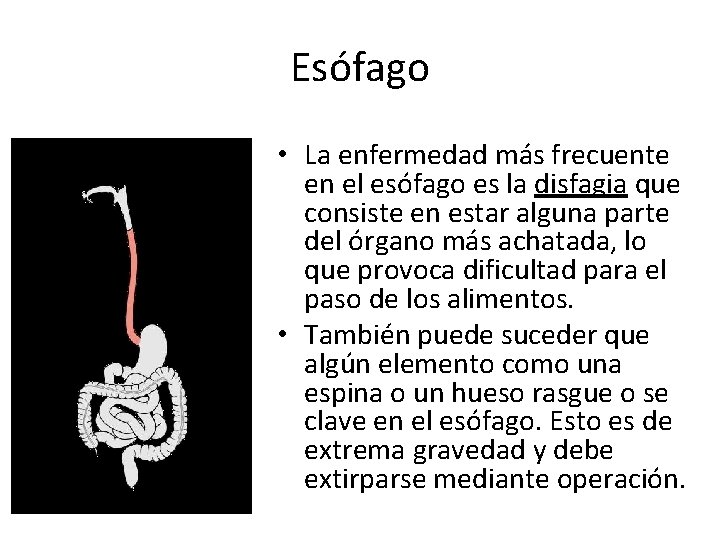 Esófago • La enfermedad más frecuente en el esófago es la disfagia que consiste