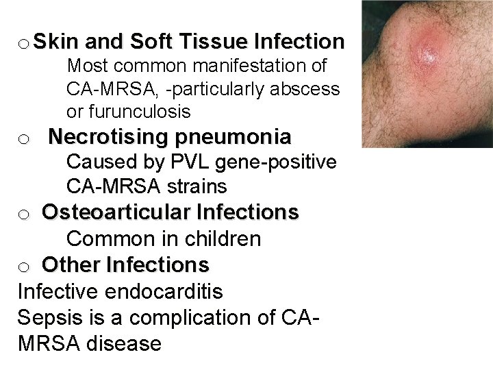 o Skin and Soft Tissue Infection Most common manifestation of CA-MRSA, -particularly abscess or