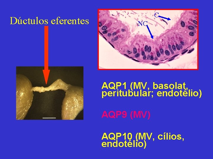 Dúctulos eferentes C NC AQP 1 (MV, basolat, peritubular; endotélio) AQP 9 (MV) AQP