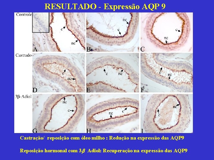 RESULTADO - Expressão AQP 9 Castração/ reposição com óleo milho : Redução na expressão
