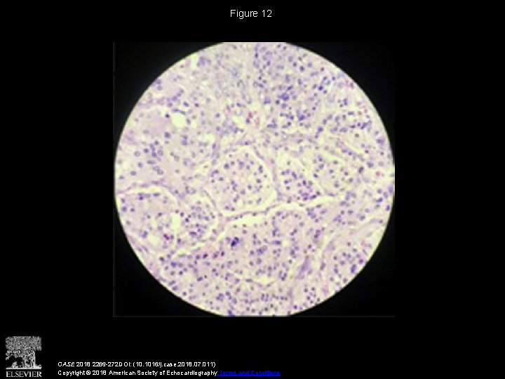 Figure 12 CASE 2018 2266 -272 DOI: (10. 1016/j. case. 2018. 07. 011) Copyright