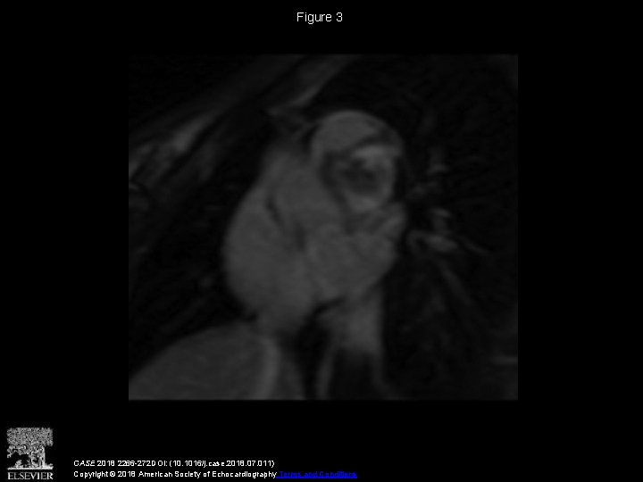 Figure 3 CASE 2018 2266 -272 DOI: (10. 1016/j. case. 2018. 07. 011) Copyright