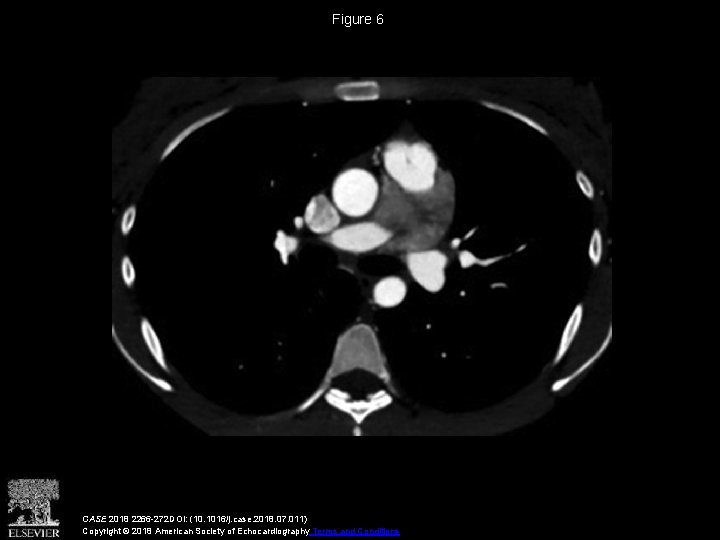 Figure 6 CASE 2018 2266 -272 DOI: (10. 1016/j. case. 2018. 07. 011) Copyright