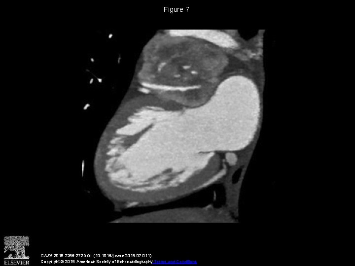 Figure 7 CASE 2018 2266 -272 DOI: (10. 1016/j. case. 2018. 07. 011) Copyright