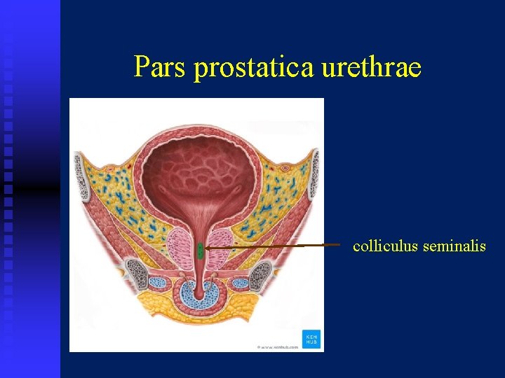Pars prostatica urethrae colliculus seminalis 