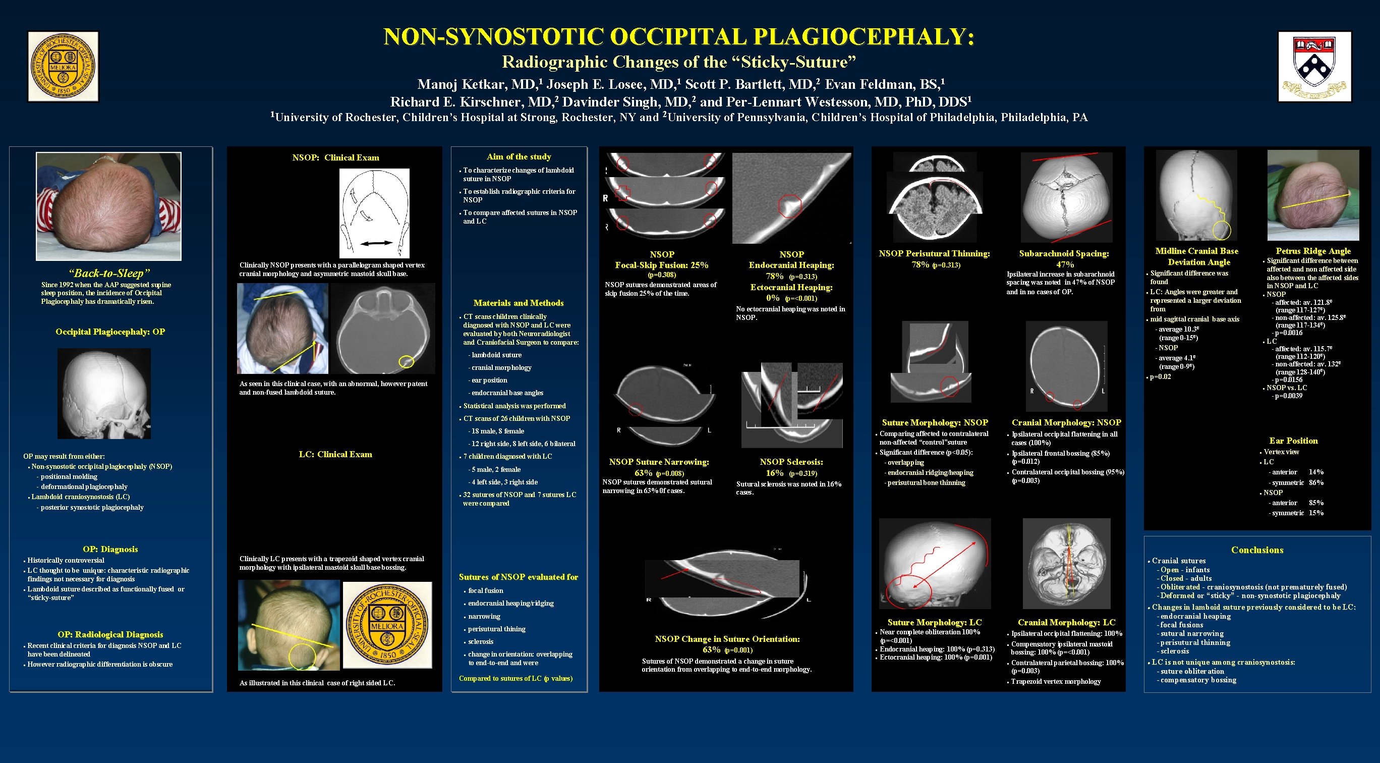NON-SYNOSTOTIC OCCIPITAL PLAGIOCEPHALY: Radiographic Changes of the “Sticky-Suture” 1 University Manoj Ketkar, MD, 1