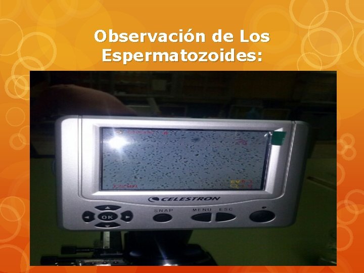 Observación de Los Espermatozoides: 