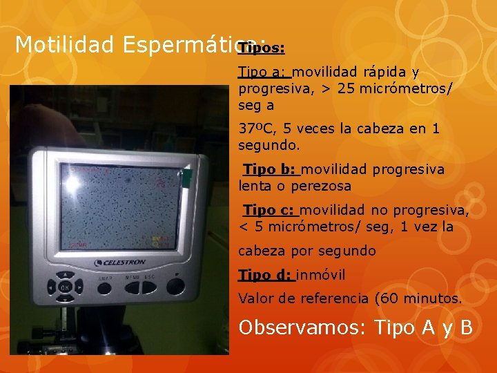 Motilidad Espermática: Tipos: Tipo a: movilidad rápida y progresiva, > 25 micrómetros/ seg a