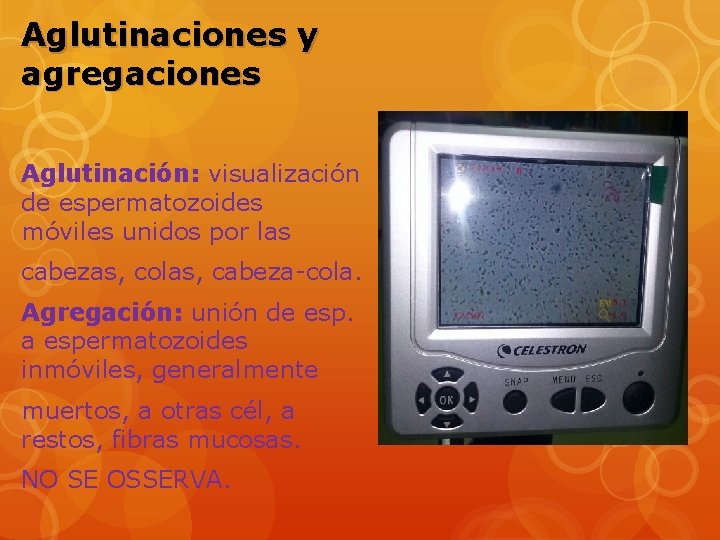 Aglutinaciones y agregaciones Aglutinación: visualización de espermatozoides móviles unidos por las cabezas, colas, cabeza-cola.