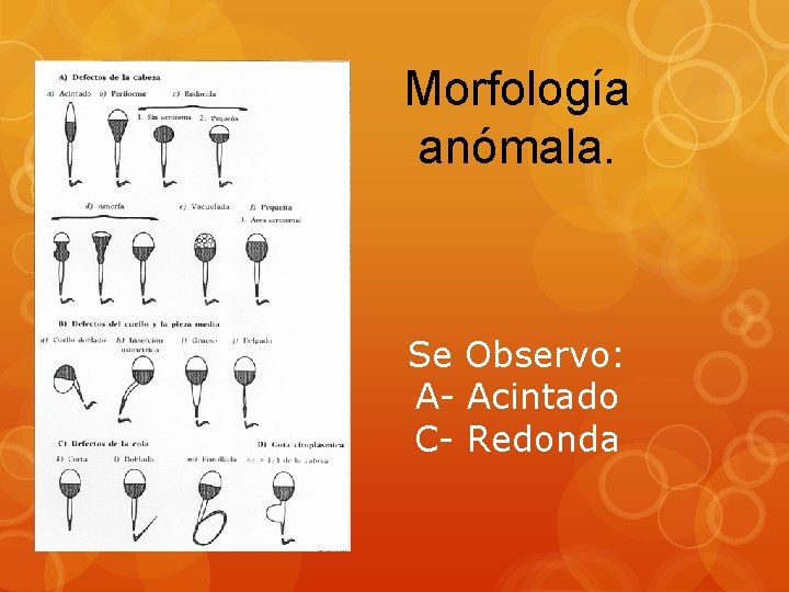 Morfología anómala. Se Observo: A- Acintado C- Redonda 