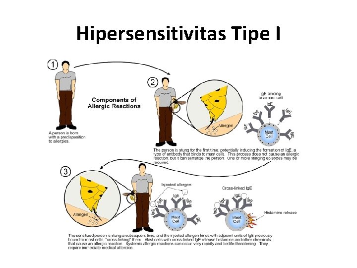 Hipersensitivitas Tipe I 