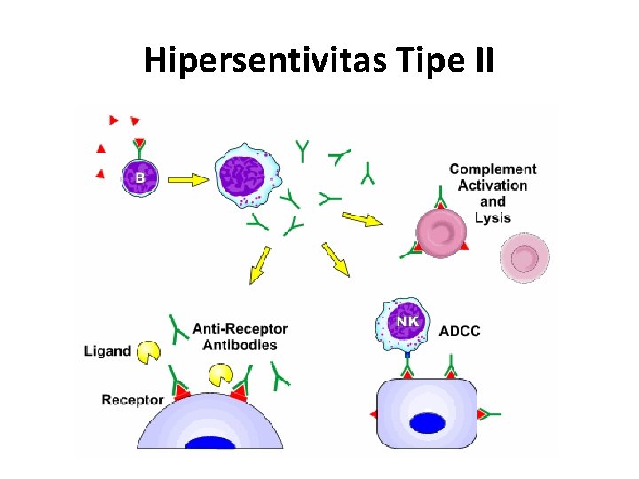 Hipersentivitas Tipe II 