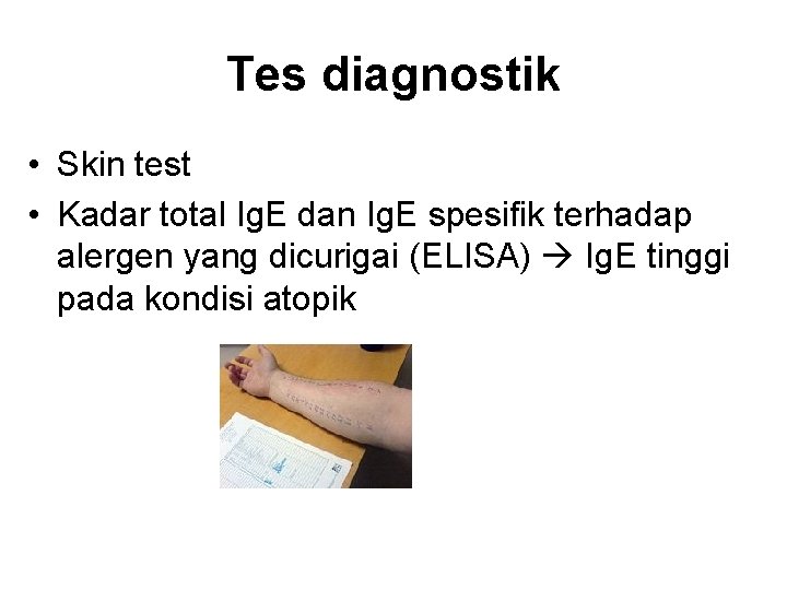 Tes diagnostik • Skin test • Kadar total Ig. E dan Ig. E spesifik
