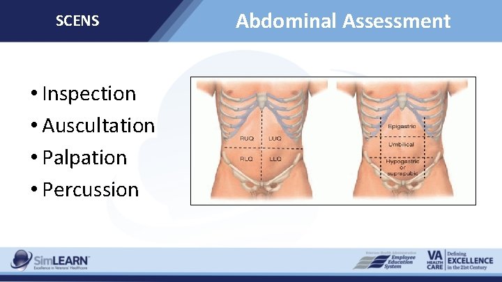 SCENS • Inspection • Auscultation • Palpation • Percussion Abdominal Assessment 