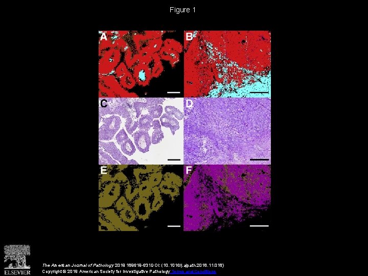 Figure 1 The American Journal of Pathology 2019 189619 -631 DOI: (10. 1016/j. ajpath.