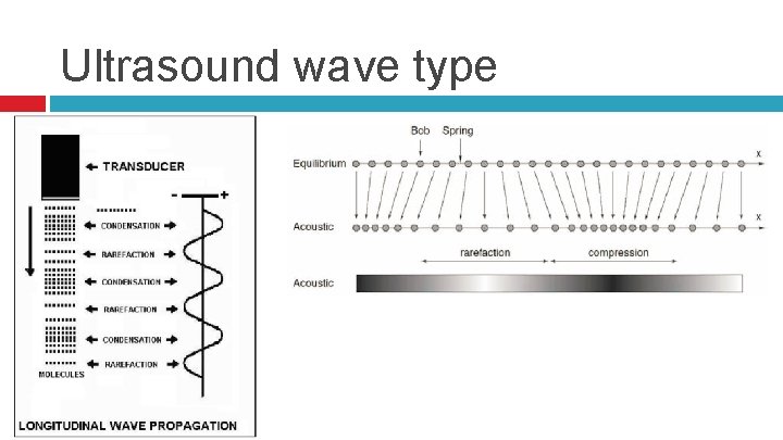 Ultrasound wave type 