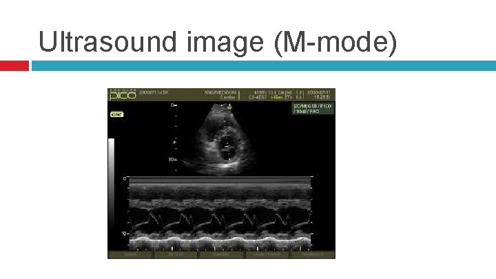 Ultrasound image (M-mode) 