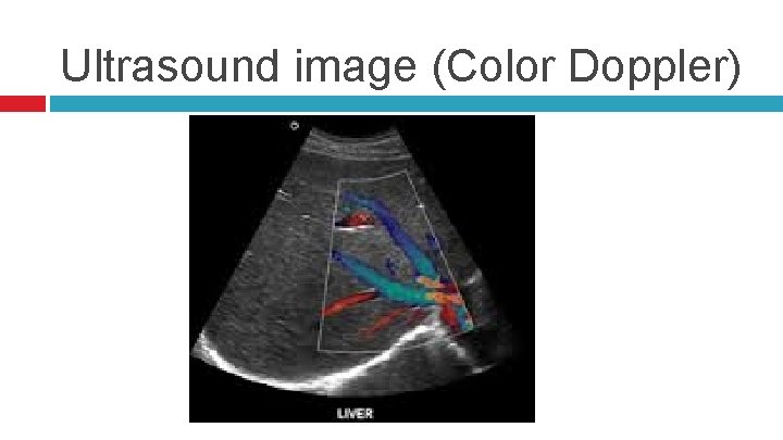 Ultrasound image (Color Doppler) 