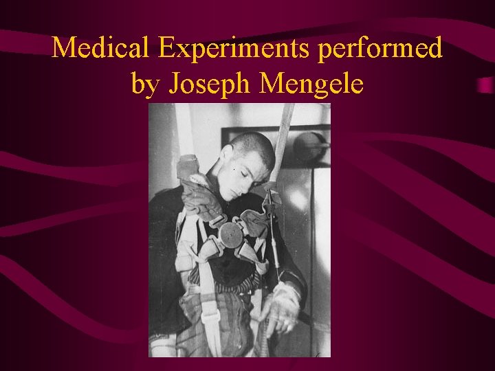 Medical Experiments performed by Joseph Mengele 