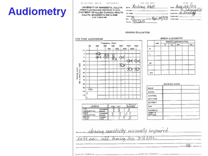 Audiometry 10 