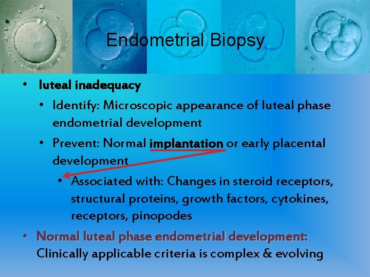 Endometrial Biopsy • luteal inadequacy • Identify: Microscopic appearance of luteal phase endometrial development