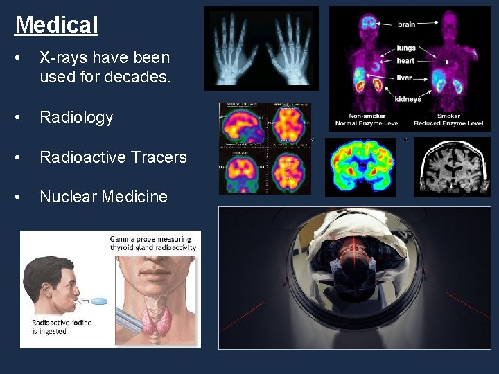 Medical • X-rays have been used for decades. • Radiology • Radioactive Tracers •