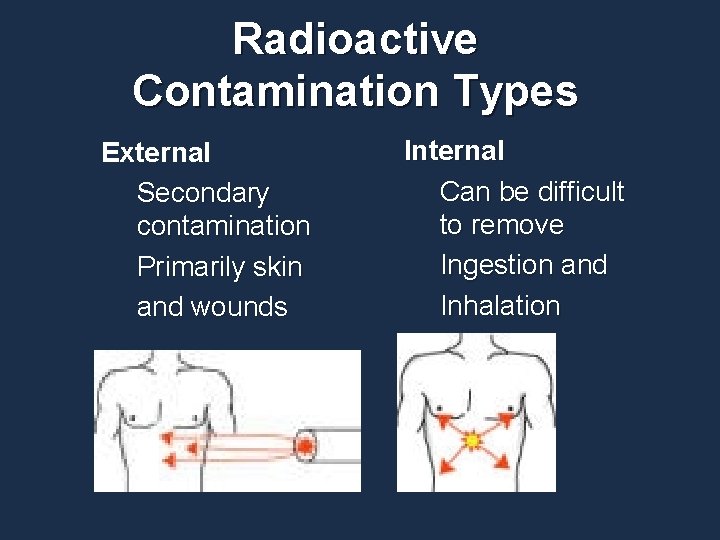 Radioactive Contamination Types External Secondary contamination Primarily skin and wounds Internal Can be difficult