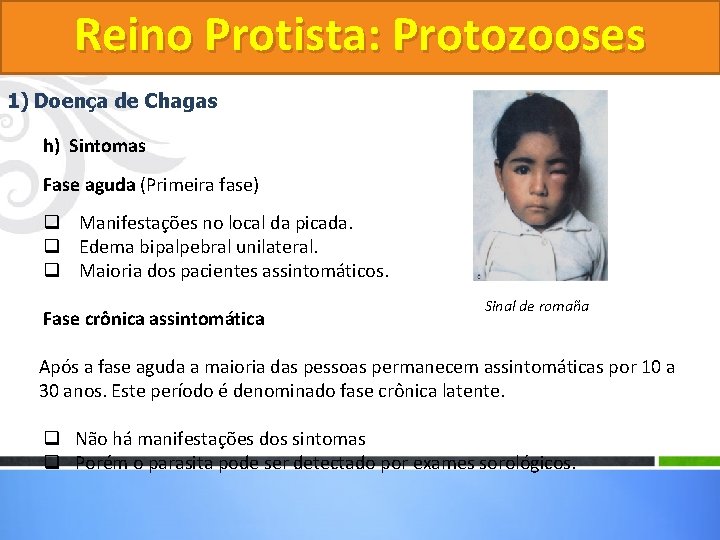 Reino Protista: Protozooses 1) Doença de Chagas h) Sintomas Fase aguda (Primeira fase) q Reino Protista: Protozooses 1) Doença de Chagas h) Sintomas Fase aguda (Primeira fase) q
