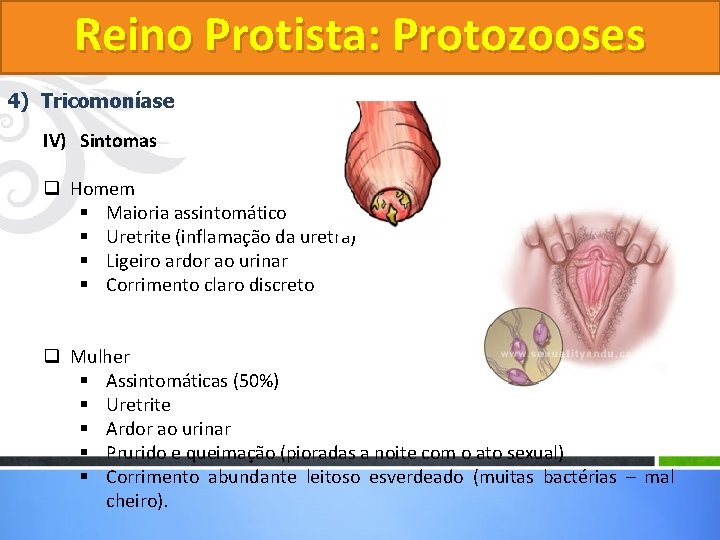 Reino Protista: Protozooses 4) Tricomoníase IV) Sintomas q Homem § Maioria assintomático § Uretrite Reino Protista: Protozooses 4) Tricomoníase IV) Sintomas q Homem § Maioria assintomático § Uretrite