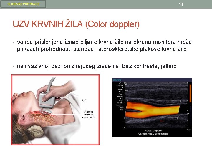 SLIKOVNE PRETRAGE 11 UZV KRVNIH ŽILA (Color doppler) • sonda prislonjena iznad ciljane krvne SLIKOVNE PRETRAGE 11 UZV KRVNIH ŽILA (Color doppler) • sonda prislonjena iznad ciljane krvne