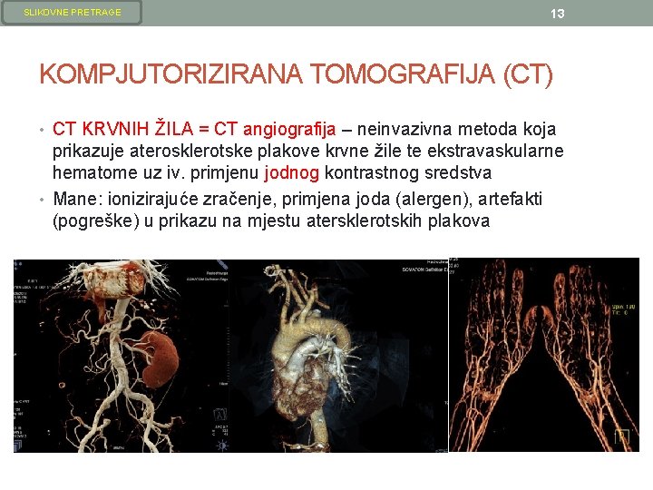 SLIKOVNE PRETRAGE 13 KOMPJUTORIZIRANA TOMOGRAFIJA (CT) • CT KRVNIH ŽILA = CT angiografija – SLIKOVNE PRETRAGE 13 KOMPJUTORIZIRANA TOMOGRAFIJA (CT) • CT KRVNIH ŽILA = CT angiografija –
