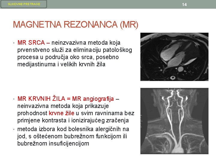 SLIKOVNE PRETRAGE MAGNETNA REZONANCA (MR) • MR SRCA – neinzvazivna metoda koja prvenstveno služi SLIKOVNE PRETRAGE MAGNETNA REZONANCA (MR) • MR SRCA – neinzvazivna metoda koja prvenstveno služi