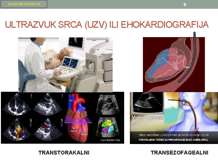 SLIKOVNE PRETRAGE 9 ULTRAZVUK SRCA (UZV) ILI EHOKARDIOGRAFIJA TRANSTORAKALNI TRANSEZOFAGEALNI SLIKOVNE PRETRAGE 9 ULTRAZVUK SRCA (UZV) ILI EHOKARDIOGRAFIJA TRANSTORAKALNI TRANSEZOFAGEALNI