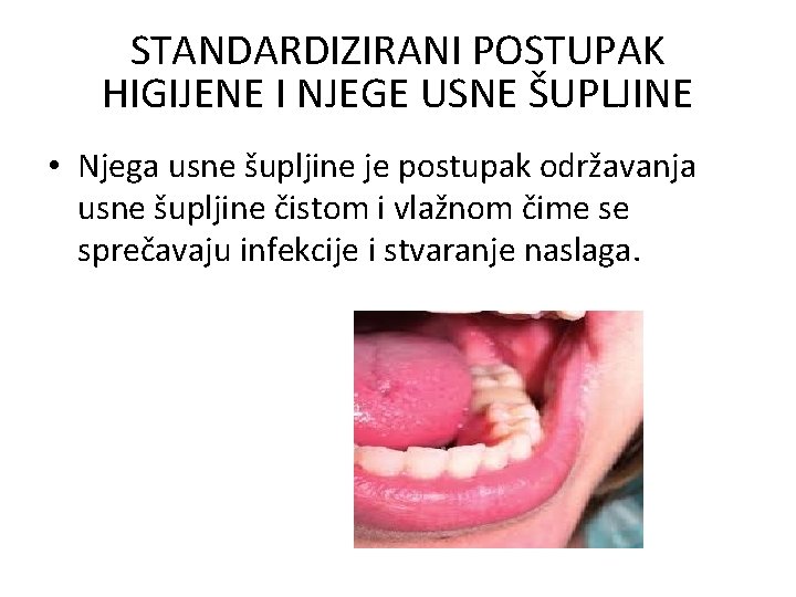 STANDARDIZIRANI POSTUPAK HIGIJENE I NJEGE USNE ŠUPLJINE • Njega usne šupljine je postupak održavanja