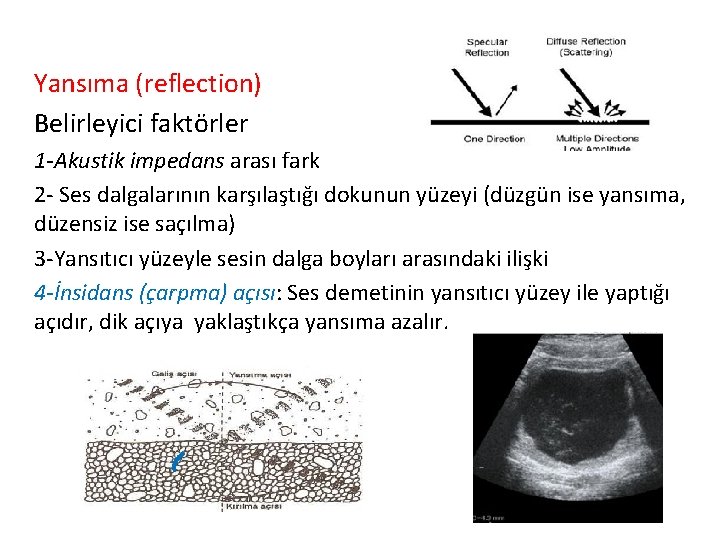 Yansıma (reflection) Belirleyici faktörler 1 -Akustik impedans arası fark 2 - Ses dalgalarının karşılaştığı