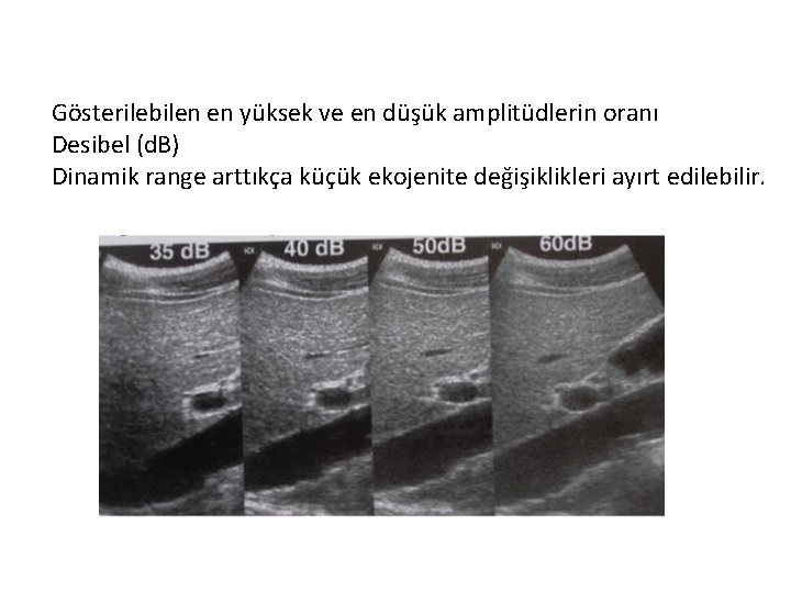 Gösterilebilen en yüksek ve en düşük amplitüdlerin oranı Desibel (d. B) Dinamik range arttıkça