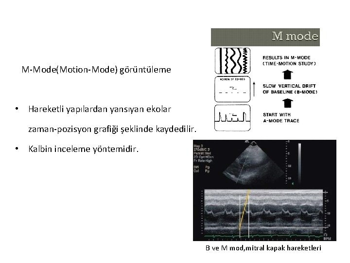 M-Mode(Motion-Mode) görüntüleme • Hareketli yapılardan yansıyan ekolar zaman-pozisyon grafiği şeklinde kaydedilir. • Kalbin inceleme