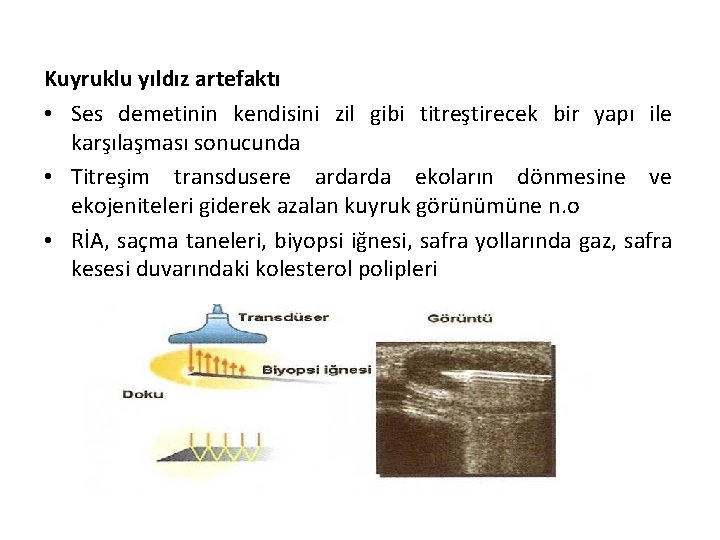 Kuyruklu yıldız artefaktı • Ses demetinin kendisini zil gibi titreştirecek bir yapı ile karşılaşması