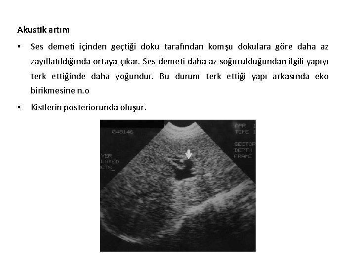 Akustik artım • Ses demeti içinden geçtiği doku tarafından komşu dokulara göre daha az