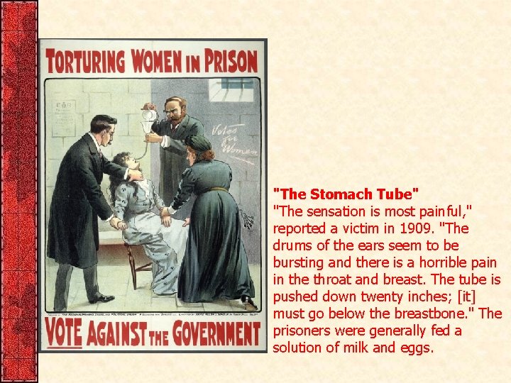"The Stomach Tube" "The sensation is most painful, " reported a victim in 1909.